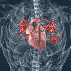 Congenital heart defects